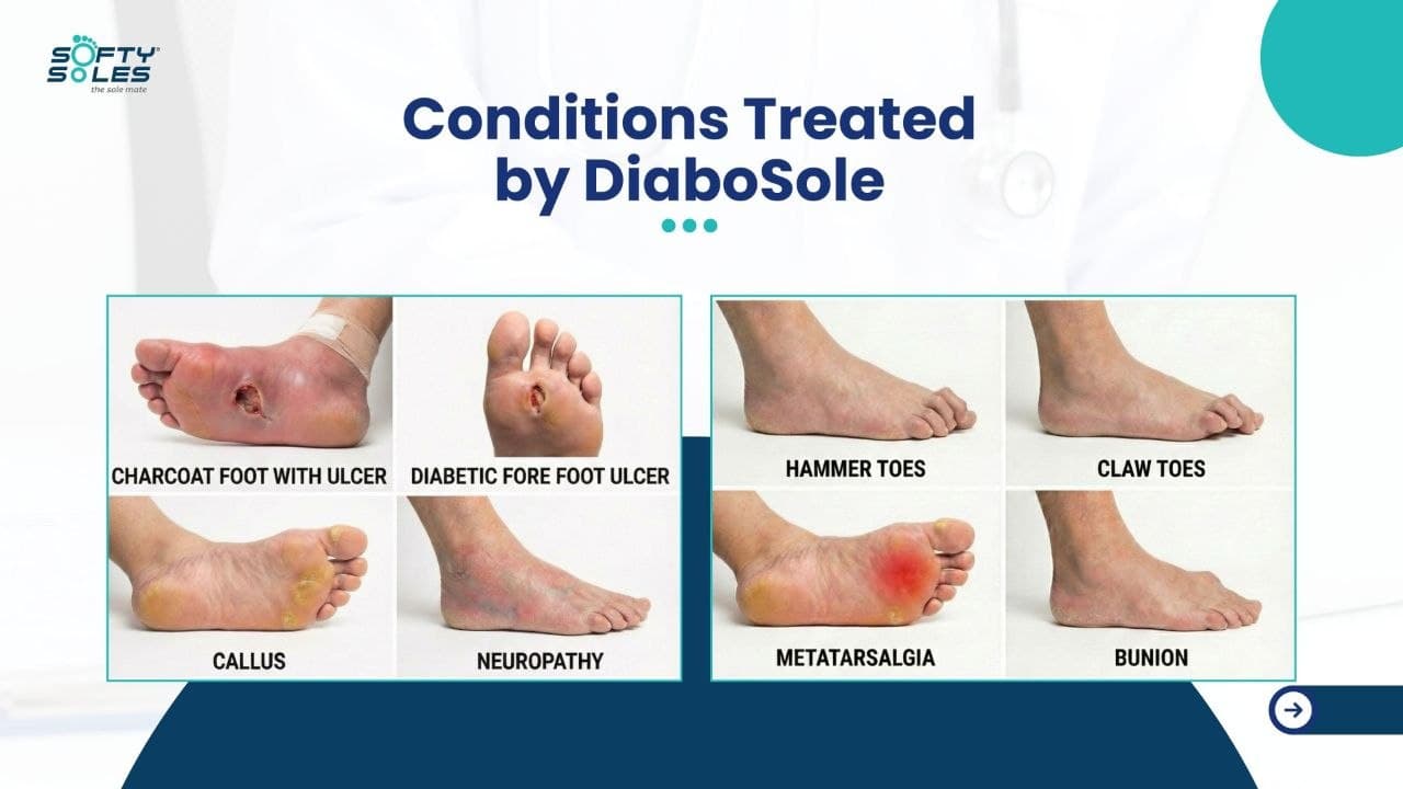 SoftySoles Orthosole – Advanced Alignment Support